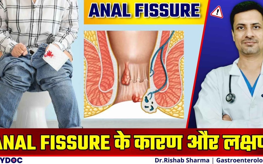 GET RID OF ANAL FISSURE | भगंदर/ANAL FISSURE क्यों होता है? | ANAL FISSURE के कारण और लक्षण