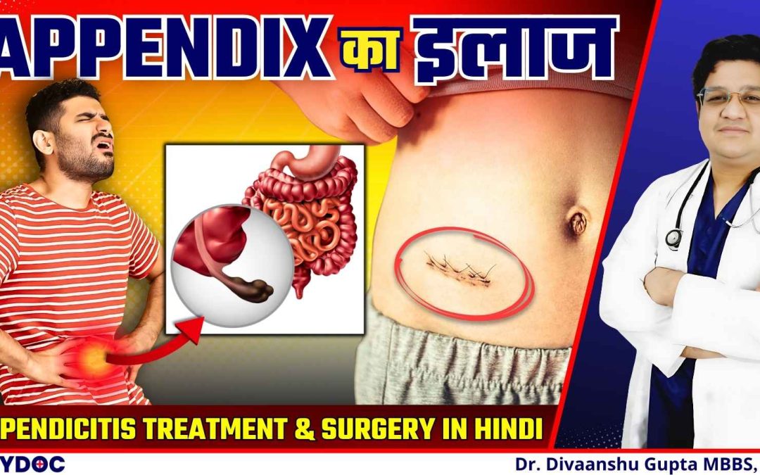 Appendix का इलाज कैसे होता है? अपेंडिक्स में सूजन Appendicitis Treatment and Appendix Surgery Hindi