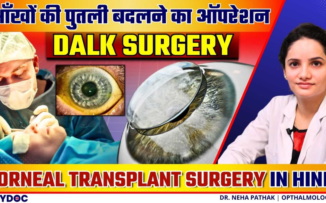 आँखों का ऑपरेशन DALK Surgery क्या है, कब पड़ती है जरूरत? | DALK Corneal Transplant Surgery In Hindi