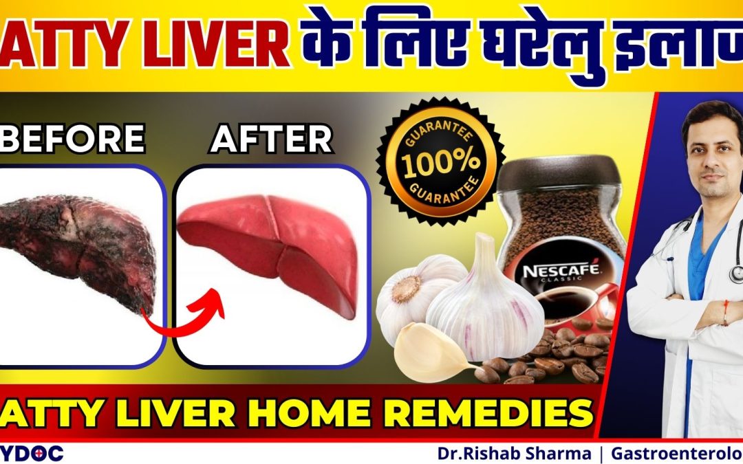 फैटी लिवर के लिए रामबाण घरेलु इलाज | Fatty Liver Home Remedies India | Fatty liver treatment