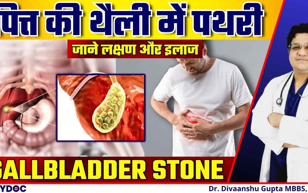 पित्त की थैली में पथरी- लक्षण, कारण, उपचार | GALLBLADDER MEIN PATHRI HONE KE KARAN in Hindi