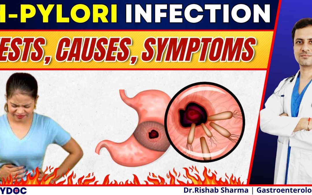 पेट में अलसर, ACIDITY | Helicobacter Pylori Infection | H-Pylori Infection Tests, Causes & Symptoms