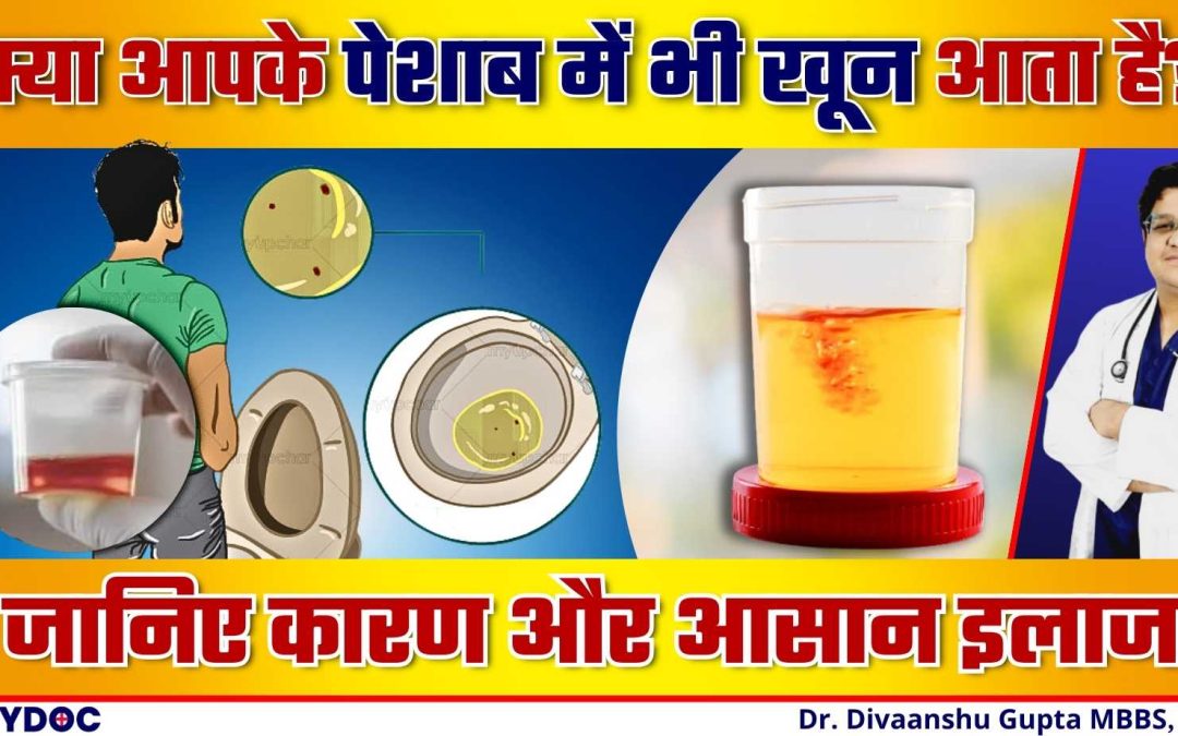 पेशाब में खून क्यों आता है? | Hematuria Treatment | पेशाब में खून के कारण और जाँच से जुड़ी जानकारी