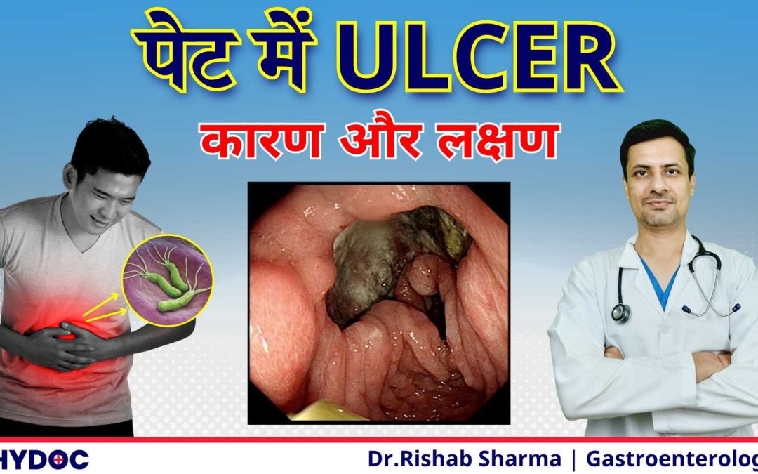 पेट के अल्सर के कारण और लक्षण | Stomach Ulcer Causes & Symptoms | Peptic Ulcer क्यु है @ThyDocHealth