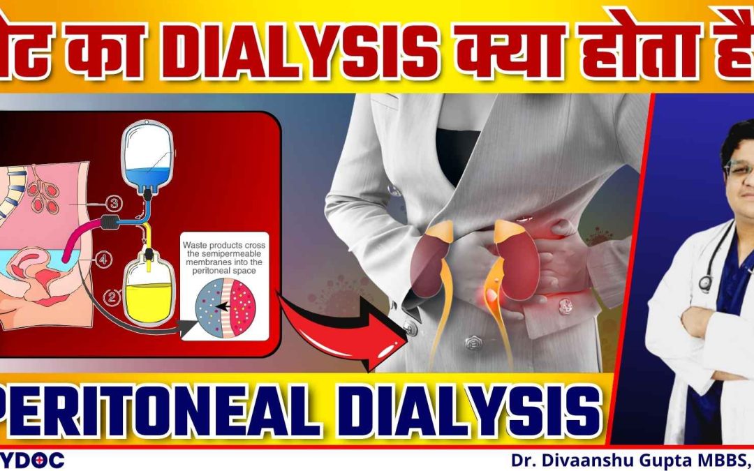 Peritoneal Dialysis in Hindi | GHAR PAR DIALYSIS Kaise Karen | Pet se Dialysis Kaise Hota Hai |