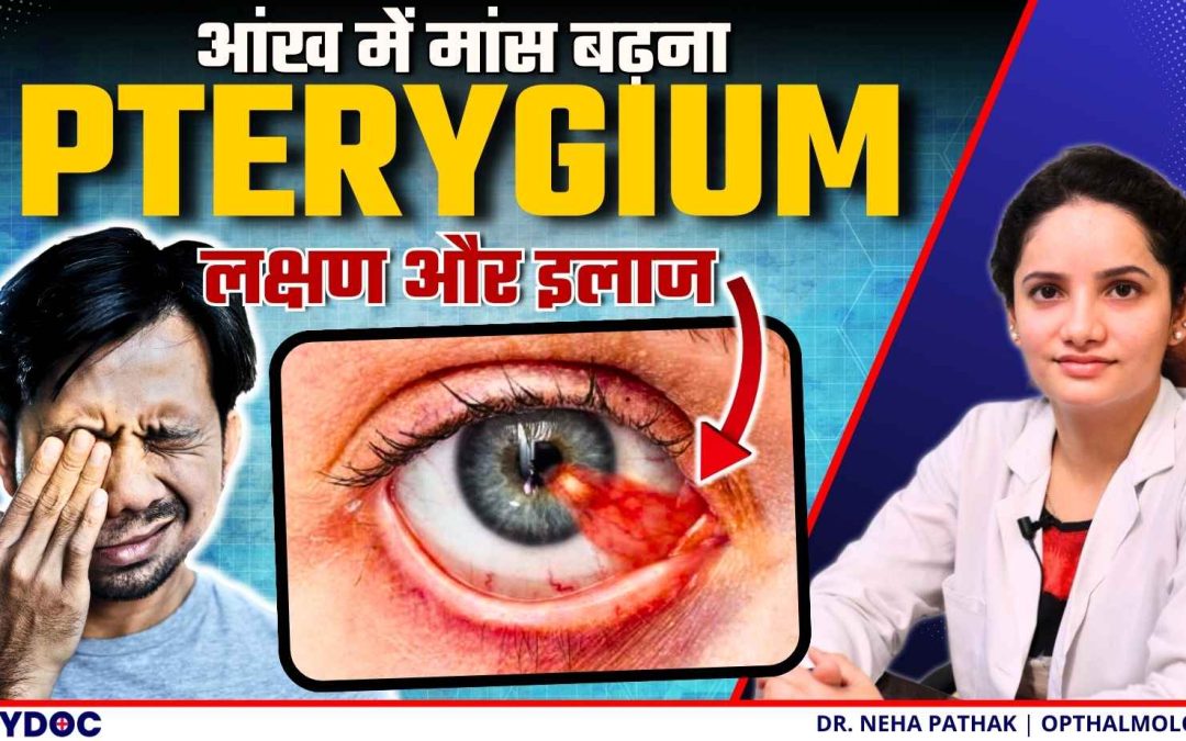 Pterygium – आंखो में नखूना के लक्षण और इलाज | Pterygium Removal Surgery | Pterygium in Hindi