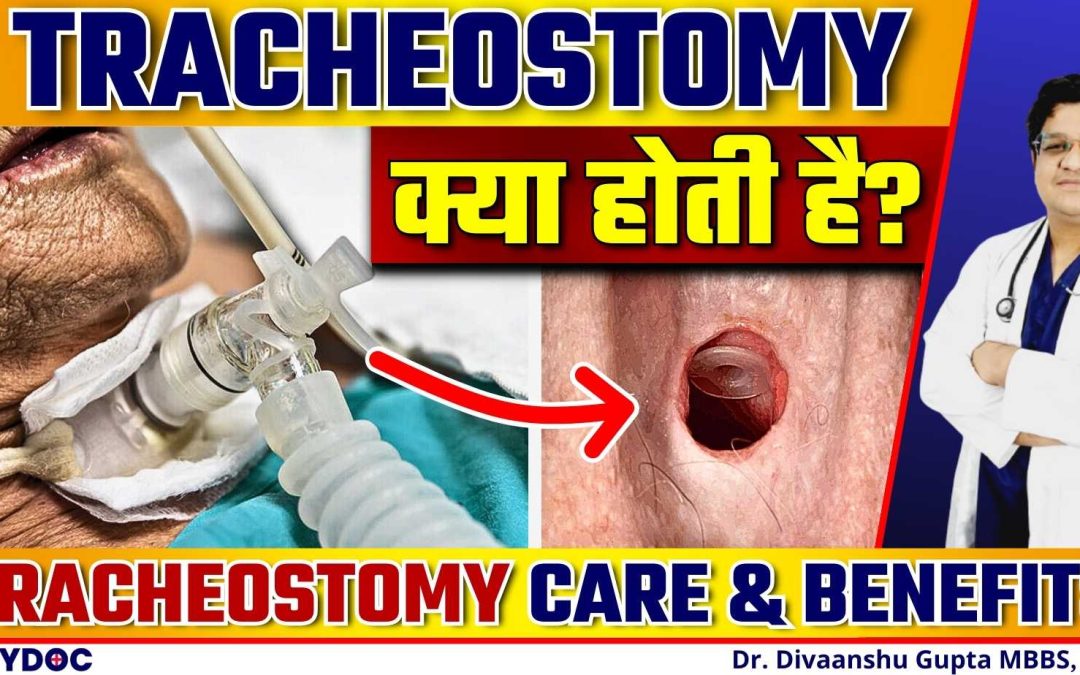 Tracheostomy क्या होती है? | जानिए Tracheostomy के Benefits और Tracheostomy Care कैसे करें in Hindi