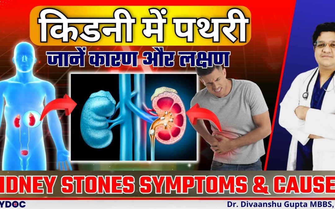 किडनी में पथरी के कारण | KIDNEY STONE Ke Karan | Causes of kidney Stones | गुर्दे की पथरी कारण
