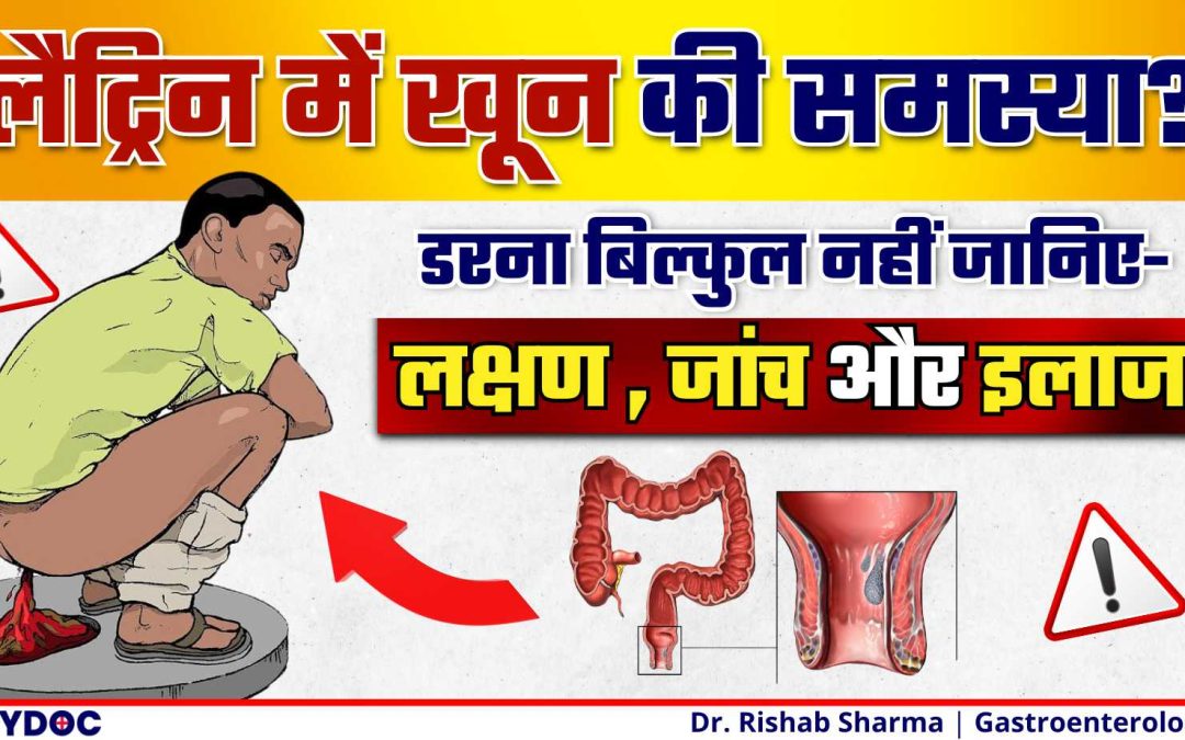 मलद्वार से खून की समस्या? | RECTAL BLEEDING | लैट्रिन में खून के लक्षण और जांच | BLOOD IN STOOL